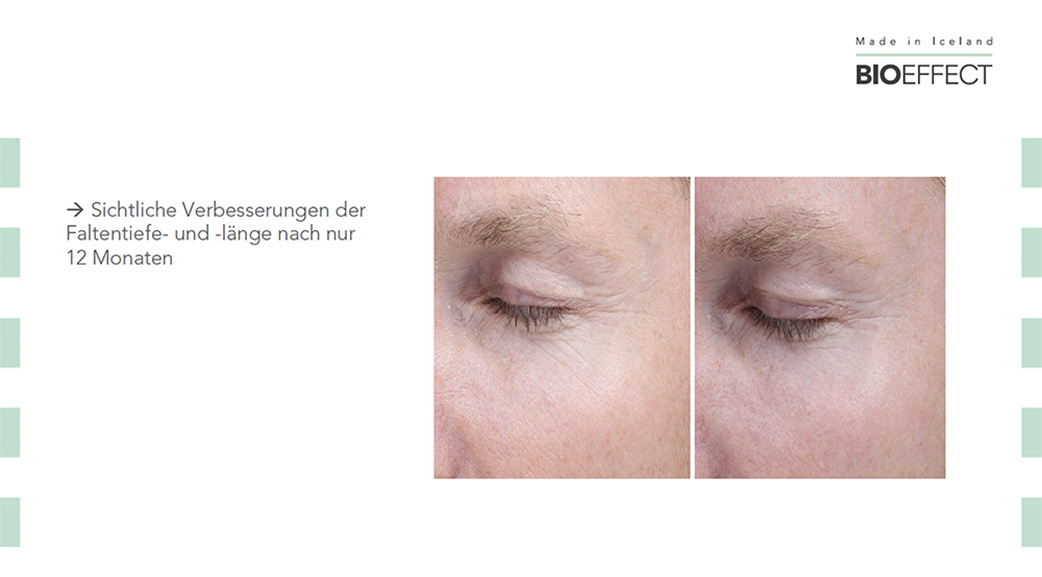 EGF Serum 15 ml